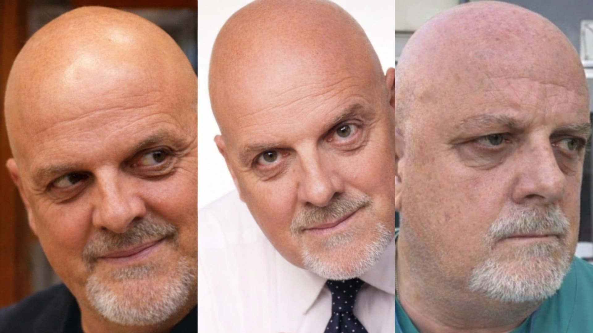 Liste d’attesa, il caso Abruzzo: controlli rinviati fino al 2029 mettono a rischio la prevenzione