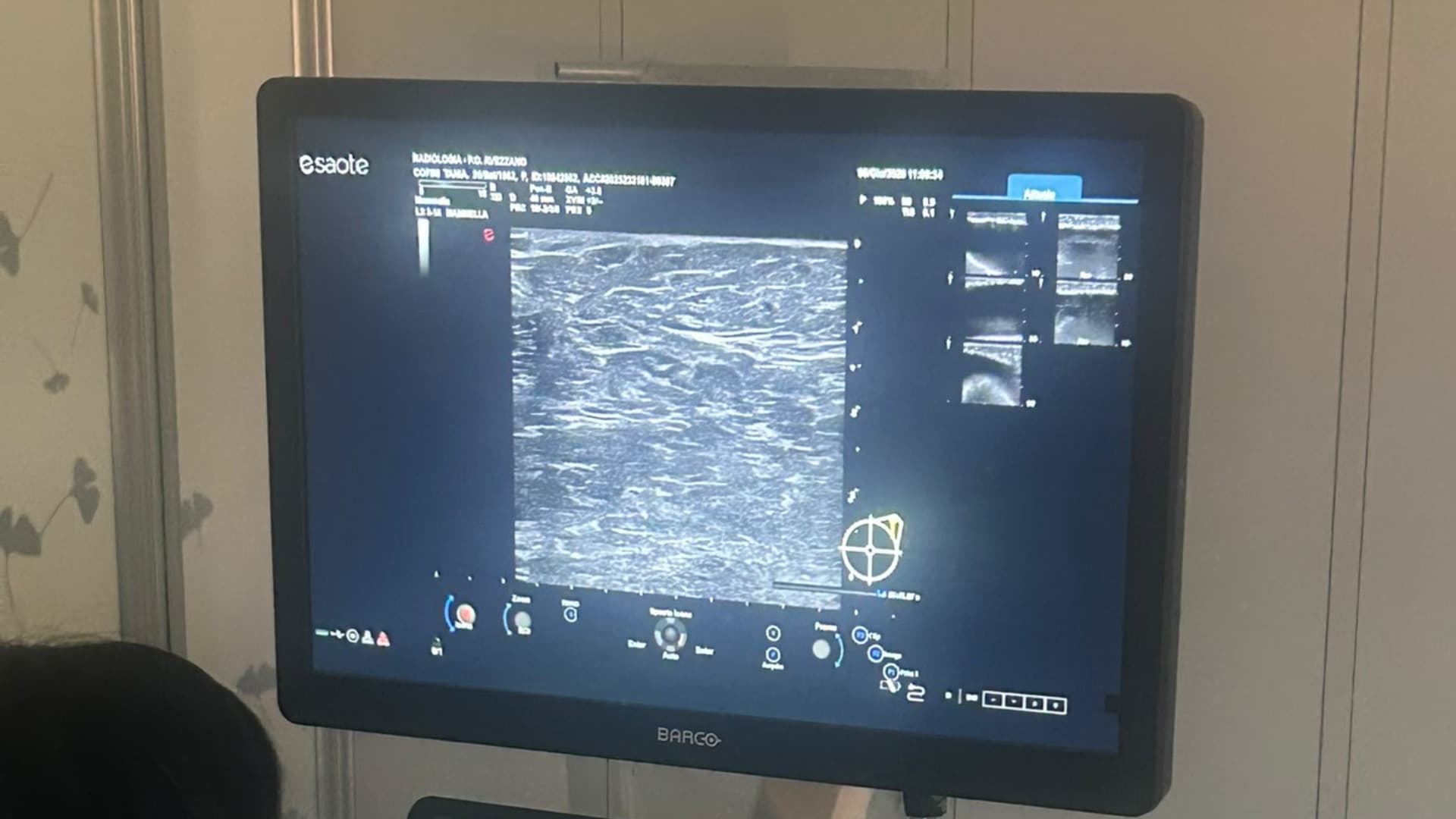 Avezzano, Radiologia dell'ospedale: ecografo di ultima generazione per diagnosi più accurate