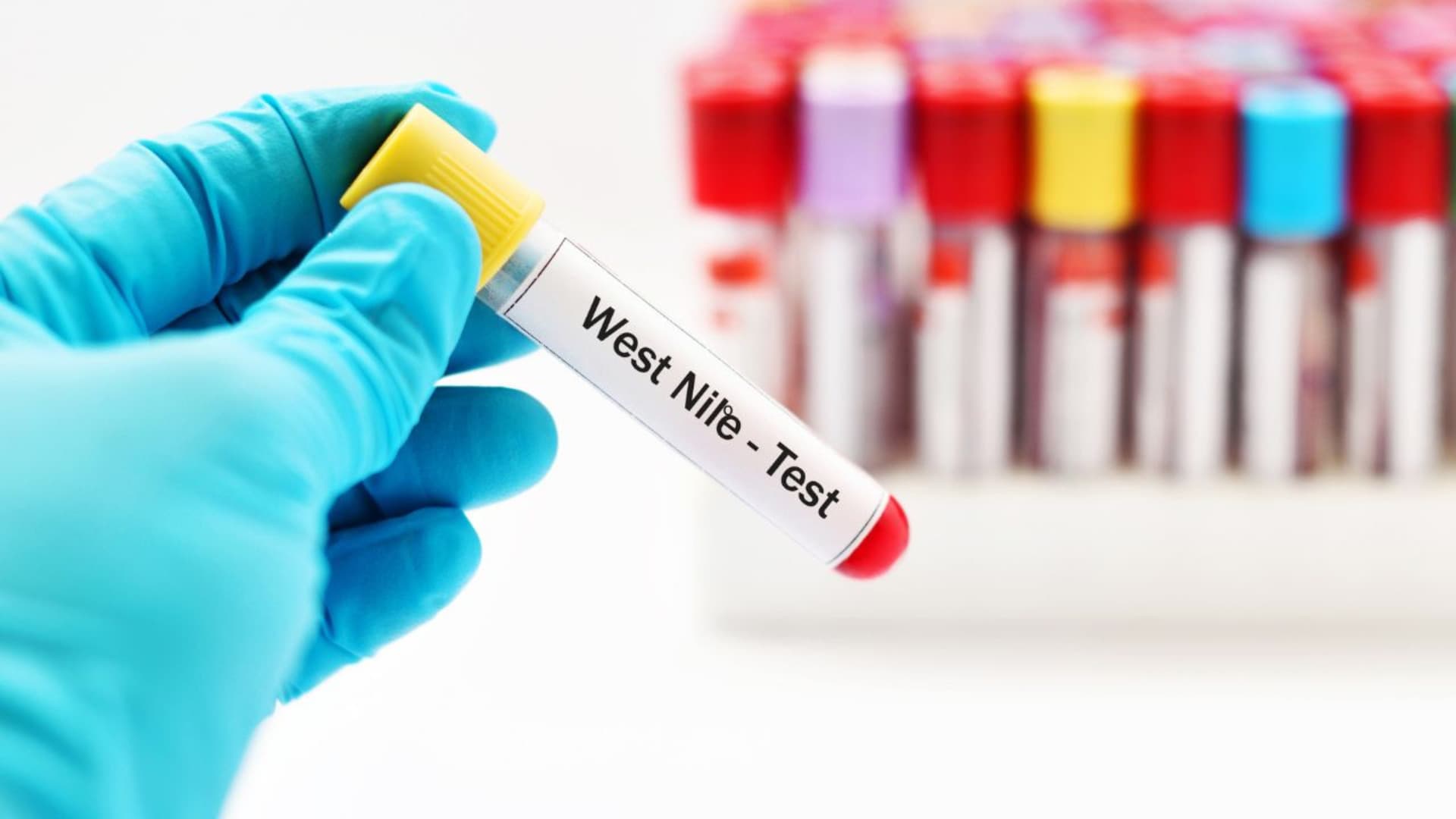 West Nile, primo caso umano del 2026 in Abruzzo: 85enne ricoverato al Mazzini - Cosa sappiamo e quali sono i rischi