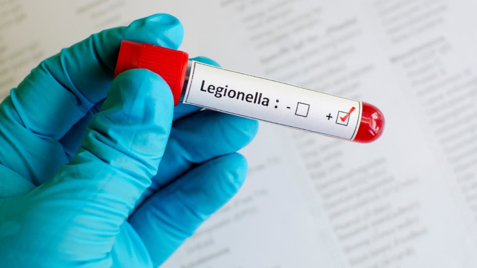 Abruzzo, legionella e nuovi ricoveri a Chieti: controlli dell'Arpa in tutta la regione